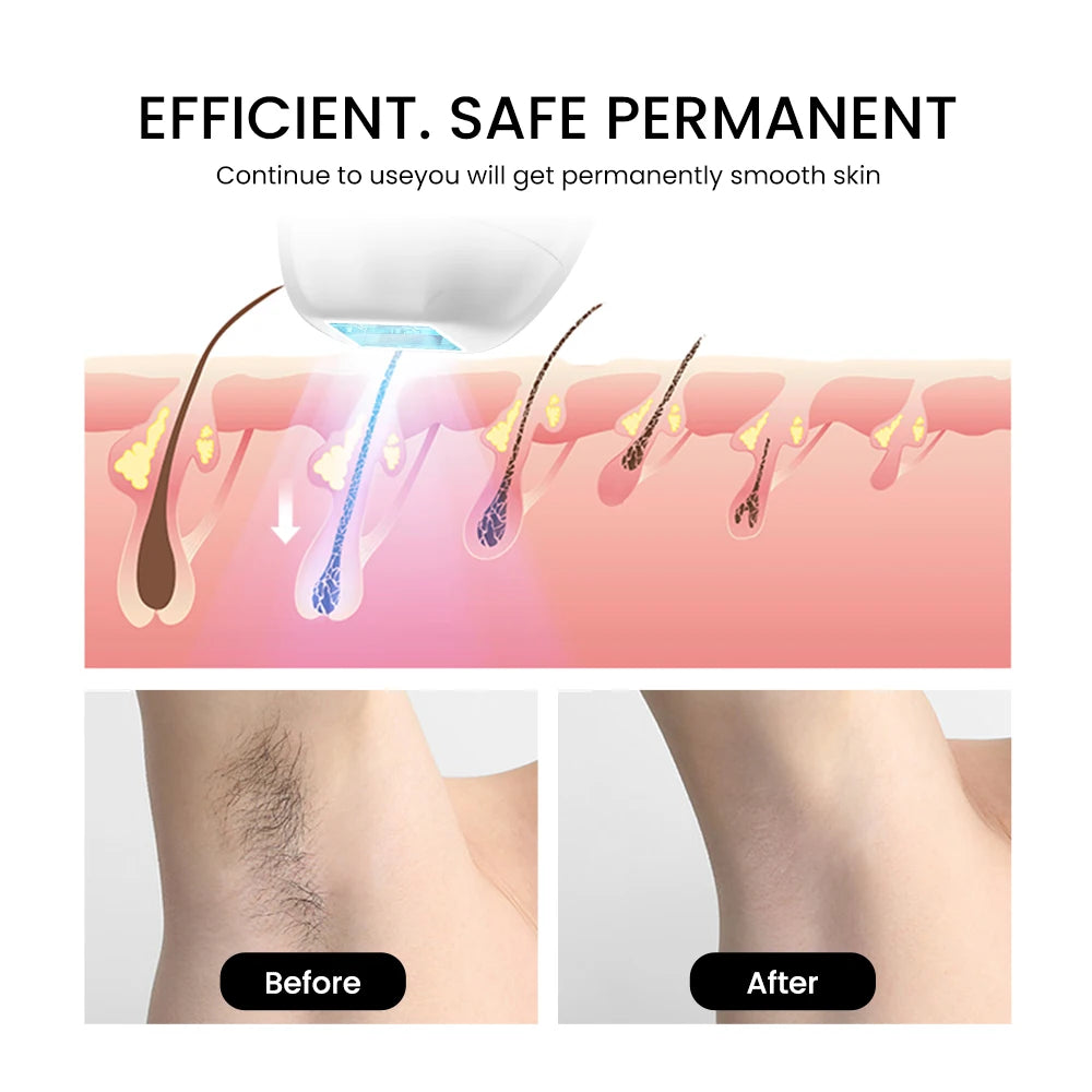 "Ultimate Home IPL Sapphire Laser Hair Removal Device - Ice Cooling Technology for Permanent Smooth Skin - Perfect for Both Women and Men!"